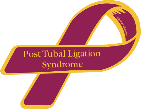 Post tubal ligation syndrome myth